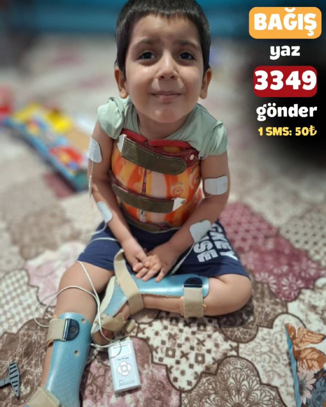 Haydi Mersin! SMA hastası minik Alim Asaf’a umut ol!