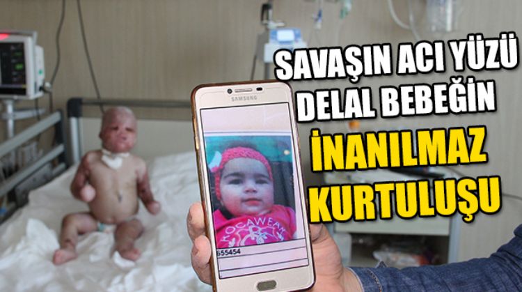 DELAL’İN ACI SAVAŞI