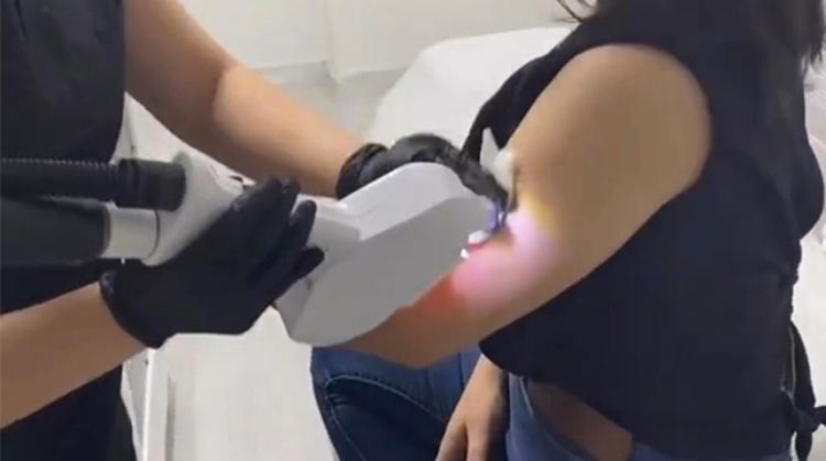 LAZER EPİLASYON İLE İSTENMEYEN TÜYLERE KESİN ÇÖZÜM