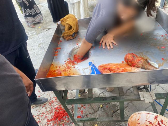 Salça yaparken feci kaza; Genç kızın eli makineye sıkıştı