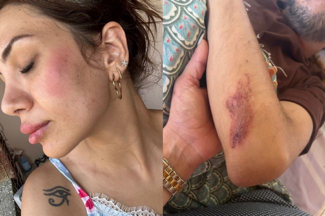Veterinere ‘Sokak köpeklerini besledin’ dayağı iddiası
