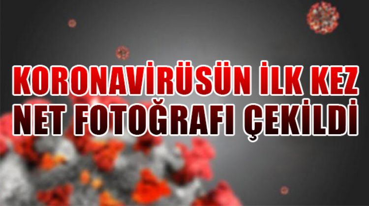 KORONAVİRÜSÜN EN NET FOTOĞRAFI ÇEKİLDİ