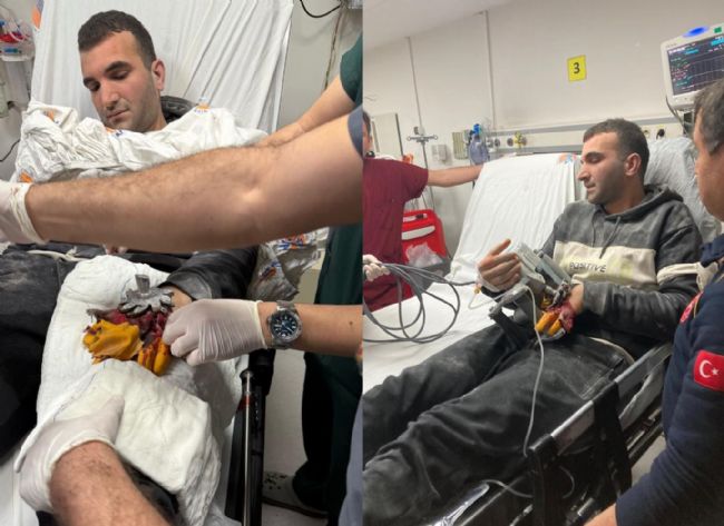 Parmağını İş Makinesine Kaptırdı