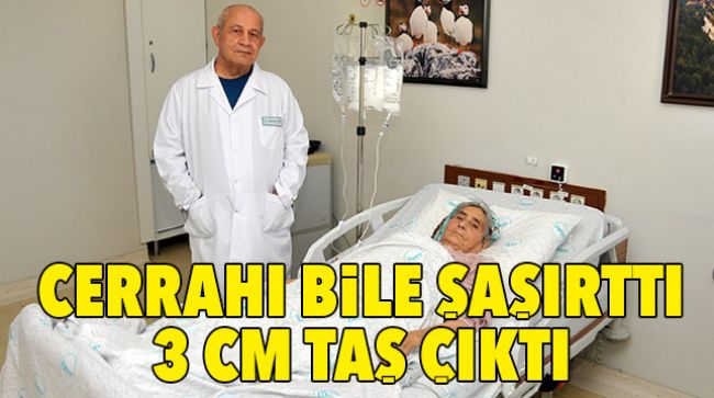 SANCI ŞİKÂYETİ İLE GİTTİ, 3 CM’LİK SAFRA TAŞI ÇIKTI