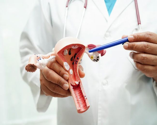 Uzmanlardan Endometriozis Uyarısı: "Kısırlığa Yol Açabilir"